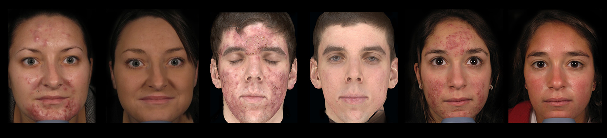 MedDerm3_bna1